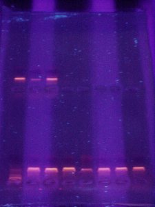 Electroforesis en gel de agarosa de molculas de ADN