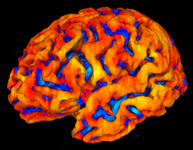 Reconstrucción del cerebro mediante resonancia magnética